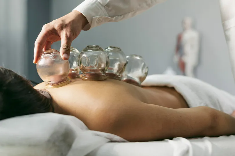 Cupping therapy